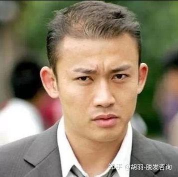 明星植发，头顶新旅程与友情力量铸就秀发重生