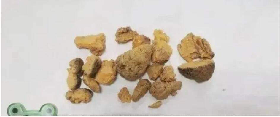 注塑环评